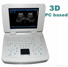 3D laptop ultrasound scanner