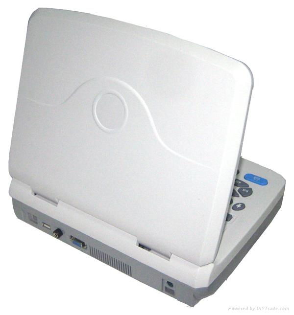 3D laptop ultrasound scanner 2