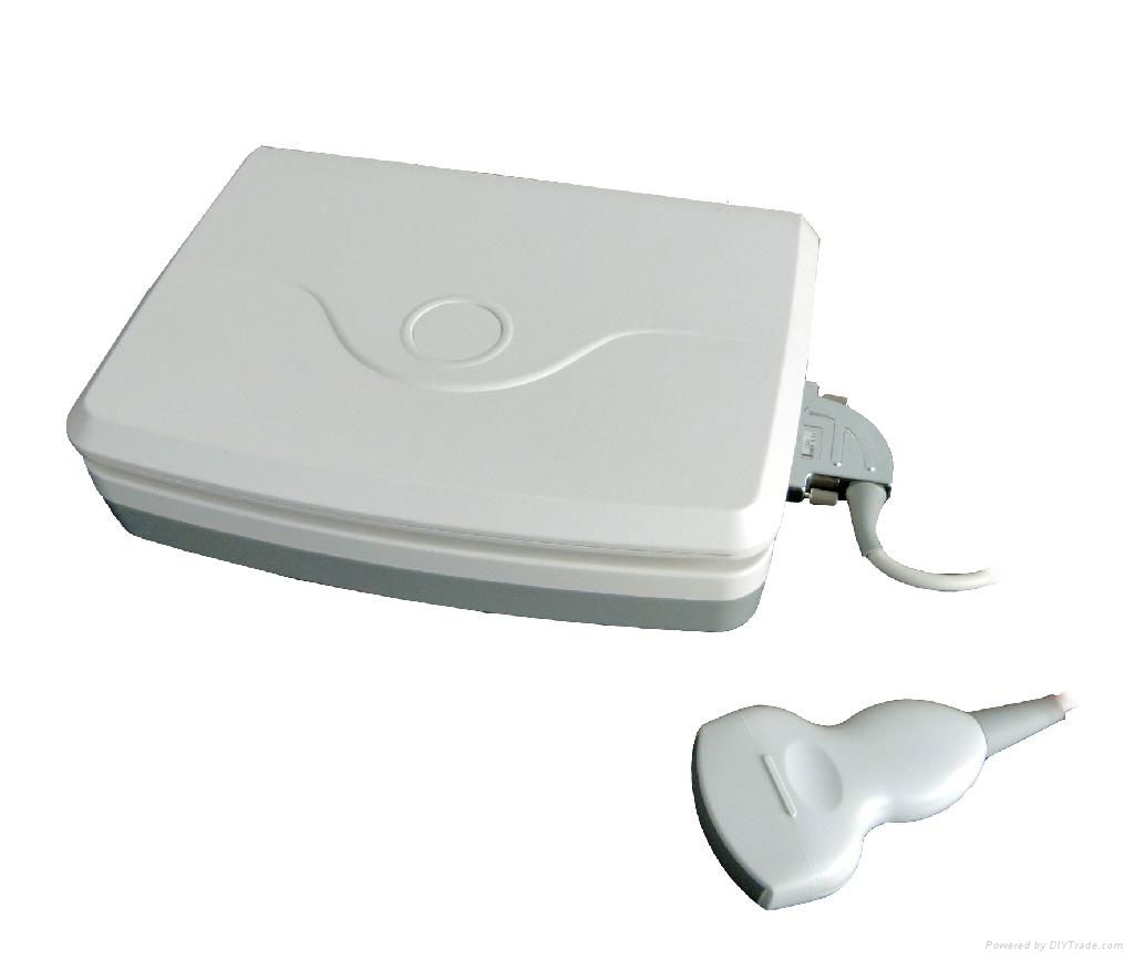 3D laptop ultrasound scanner 4