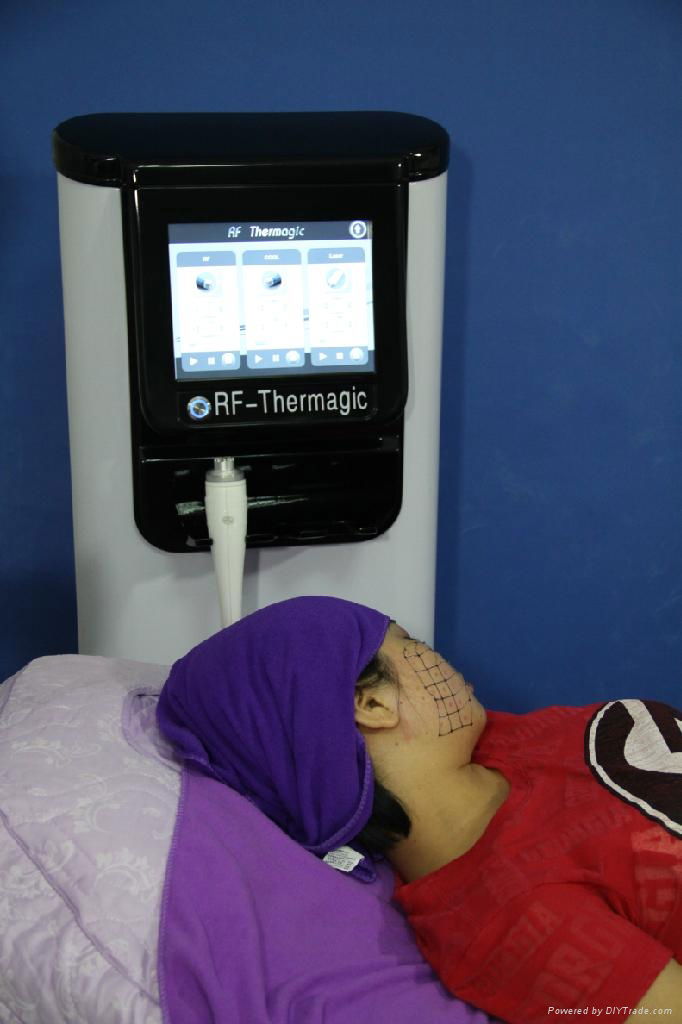 thermagic beauty machine 2