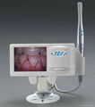 Intraoral camera