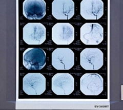 LED X-ray Film Viewer