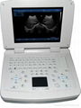 SS-10Plus 4D Laptop Ultrasound Scanner