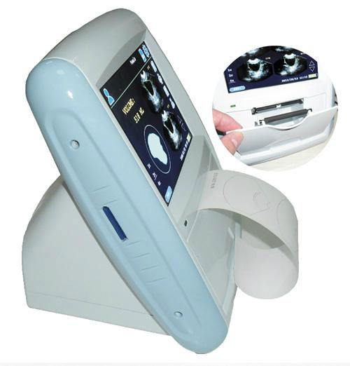 CareScan-1 ultrasound bladder scanner(Bladder Scanner, 3D bladder scanner, bladd 3