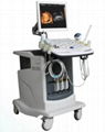 4D color doppler ultrasound scanner