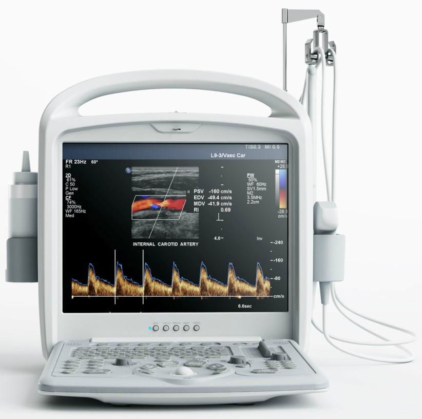 4D color doppler ultrasound scanner 3