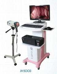 digital video colposcope