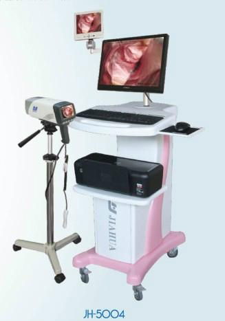 digital video colposcope 2