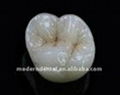 zirconia crown bridge/all ceramic zirconia/dental zirconia