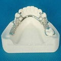 framework/metal denture/ framework dental