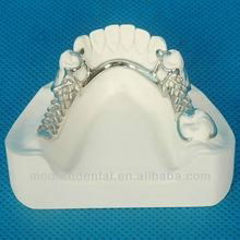 framework/metal denture/ framework dental