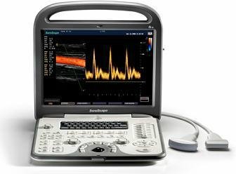Sonoscape S6 Ultrasound
