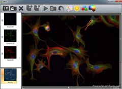 VIMAGE Microscopy Imaging Software Metallurgical Analysis