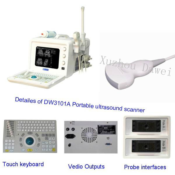 DW3101A hot sales portable full digital ultrasound machine 2