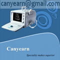 CE U625 Hand-carried Ultrasound Scanner