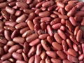 Kidney Beans 3