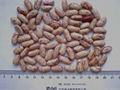 Kidney Beans 5