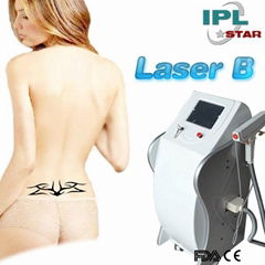 laser tattoo removal