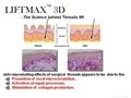 Amazing Anti-wrinkle LIFTMAX3D Cog Thread Implant 3