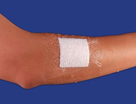 Waterproof Wound Dressing with Absorbent Pad 2