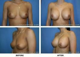 the most popular breast care product, FEG breast enlargement cream, original man 2