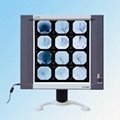 LED x-ray film viewer
