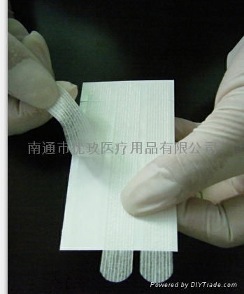 Transparent waterproof wound dressing 5