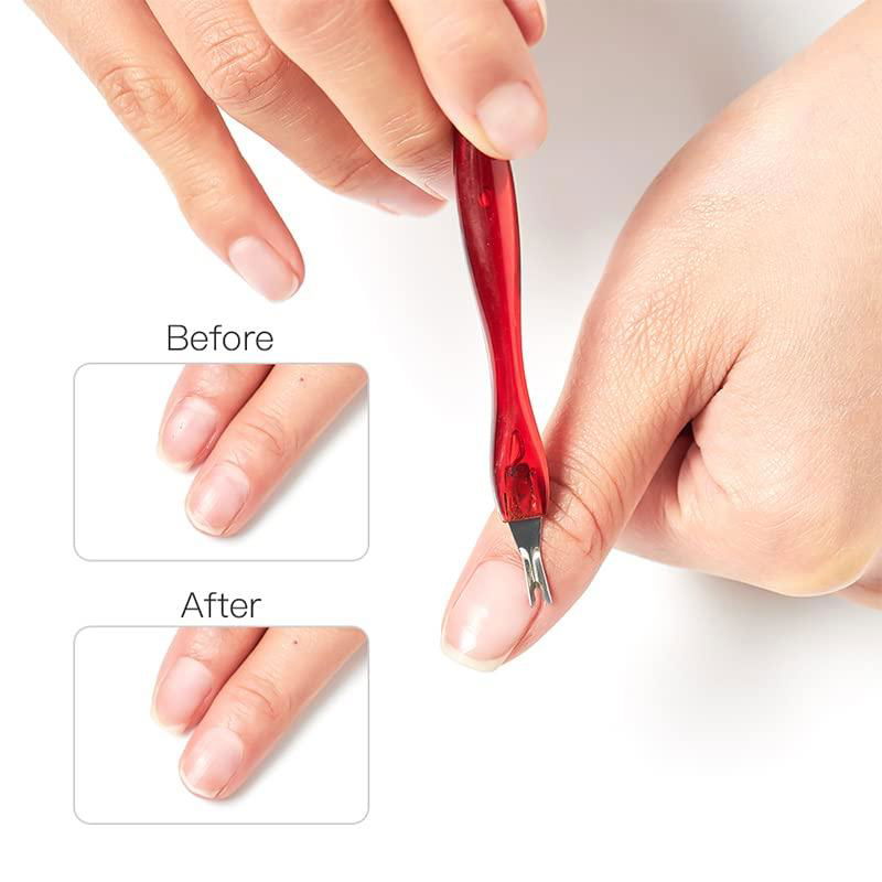 Dead Skin Cuticle Knife V-Shaped Nail Cuticle Trimmer Remover Plastic Handle 4