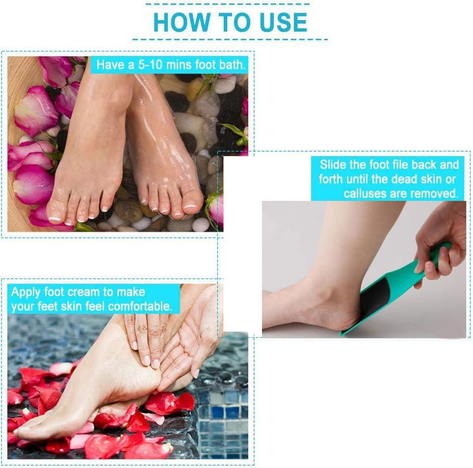 U Shaped Foot File  Foot Rubbing Board Callus  Dead Skin Remover Double-Sided  4