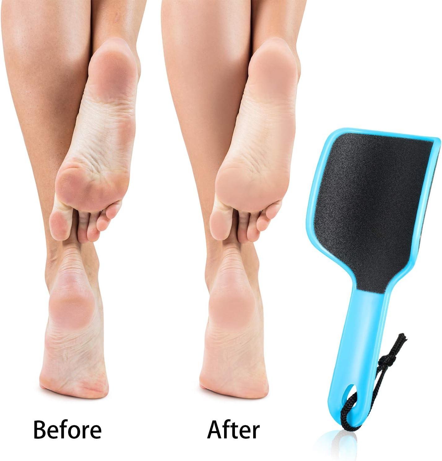 Foot File U Shaped Callus Scrubber 2-Sided Colossal Foot Heel Scrubber Shaver  2