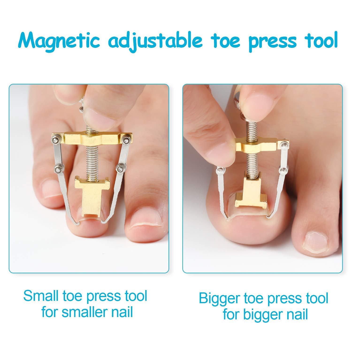 Ingrown Toe Nail Corrector foot Nail Pedicure Tool Toenail  Correction 4