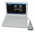 UBook-8 Ultrasound B scanner(Notebook) 1