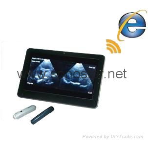 Sector Ultrasound Probe Scanner[coming soon] 2