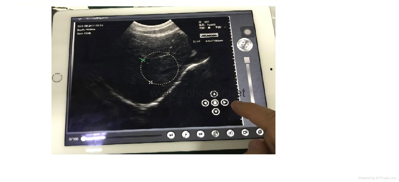 UProbe-2 Array Ultrasound Probe Scanner[coming soon] 