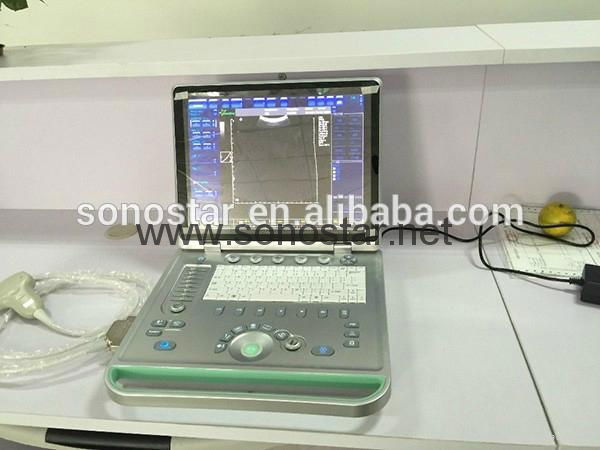 Sonostar cheap doppler ultrasound mobile color doppler ultrasound machine price  2