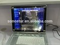 Sonostar cheap doppler ultrasound mobile color doppler ultrasound machine price  3