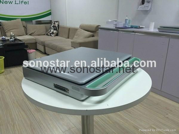Sonostar cheap doppler ultrasound mobile color doppler ultrasound machine price  4
