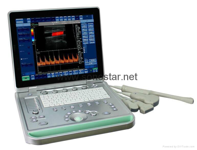 Sonostar cheap doppler ultrasound mobile color doppler ultrasound machine price  5