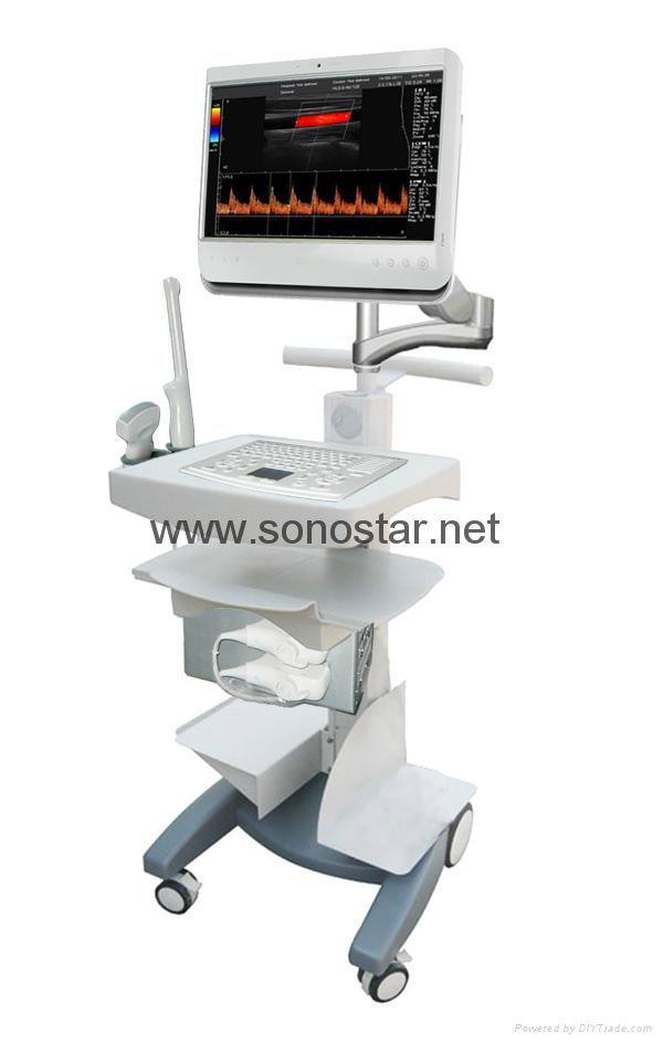 Sonostar hot sale cheap medical 3D 4D trolley ultrasound machine competitive C10