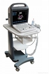 Sonostar Trolley professional color doppler ultrasound machine China ultrasound 