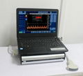 Sonostar new portable ultrasound box