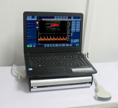 Sonostar new portable ultrasound box machine portable ultrasound units for sale 