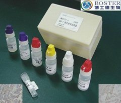 敏感性加強型原位雜交檢測試劑盒II