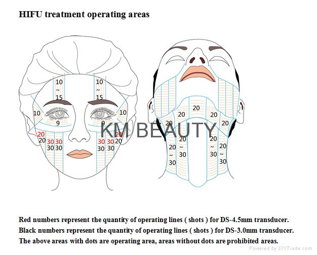 Newest HIFU face lift skin tightening weight loss machine  4