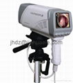 High Definition Digital Video Colposcope 2