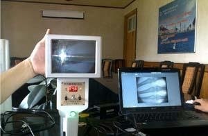 便携式X光机液晶显示器高清能透视X光机