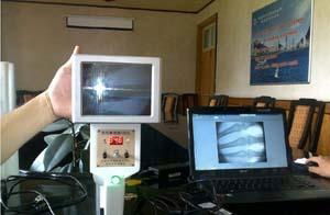便攜式X光機液晶顯示器高清能透視X光機