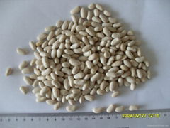 White Kidney Bean- Spanish Type