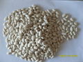 White Kidney Bean- Spanish Type 2
