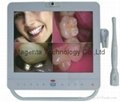 15 Inches Screen With Dental Intraoral camera System 